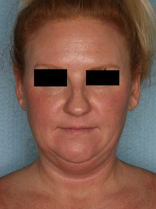 Case # 3 before photo