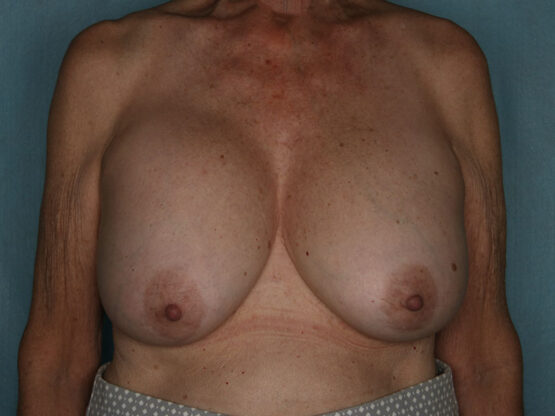 Case # 23 before photo