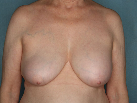 Case # 26 before photo