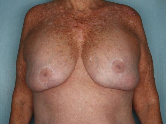 Case # 27 before photo