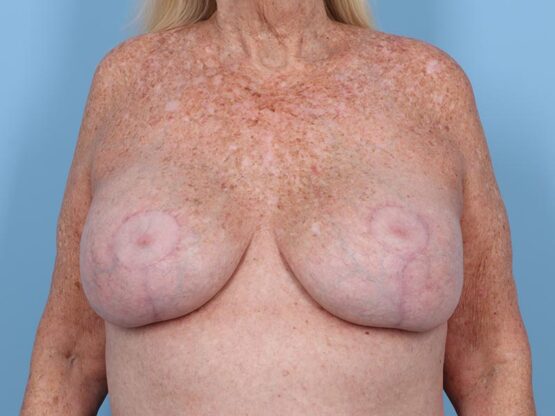 Case # 27 after photo