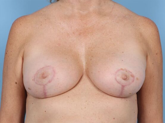 Case # 28 after photo