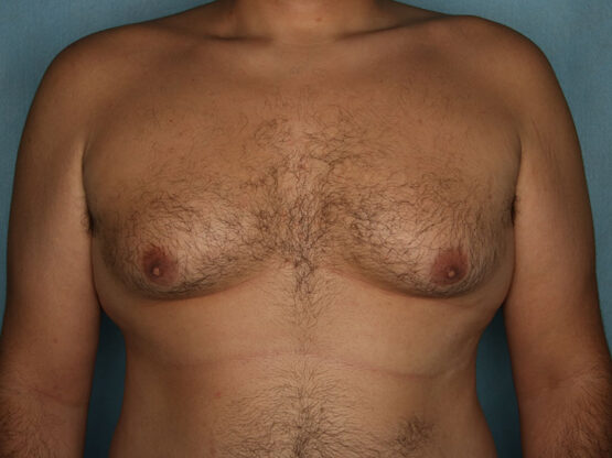 Case # 1 before photo