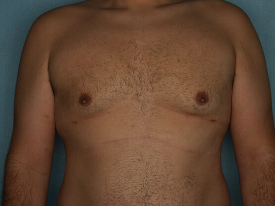 Case # 1 after photo