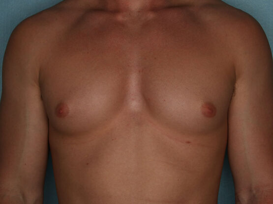 Case # 2 before photo