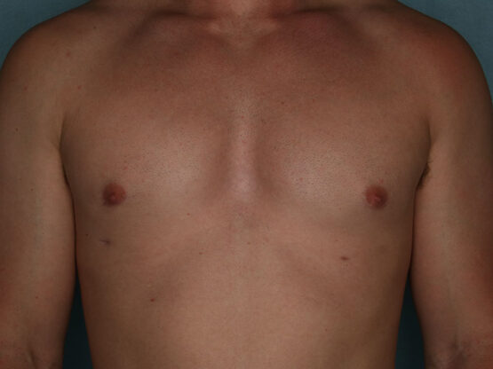 Case # 2 after photo