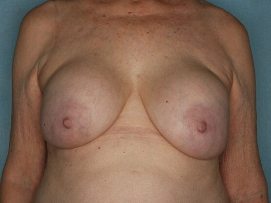 Case # 6 before photo