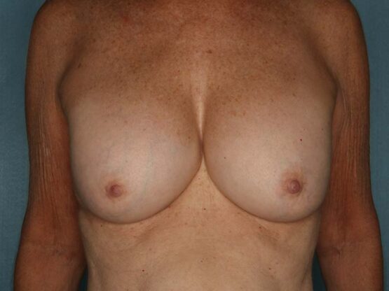 Case # 7 before photo