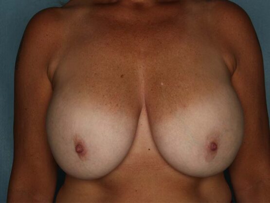 Case # 8 before photo