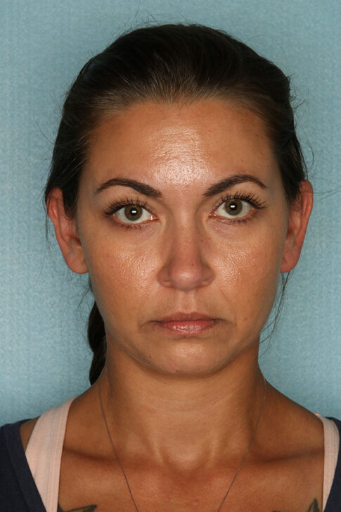 Case # 1 before photo