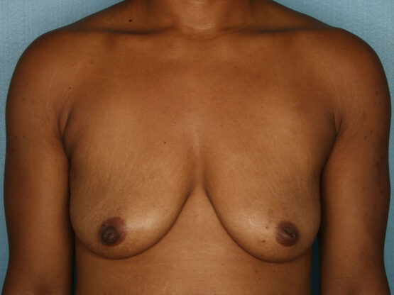 Case # 7 before photo