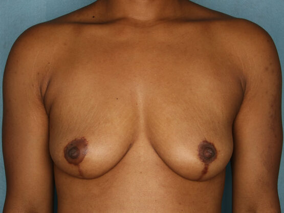 Case # 7 after photo