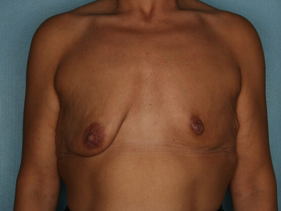 Case # 14 before photo