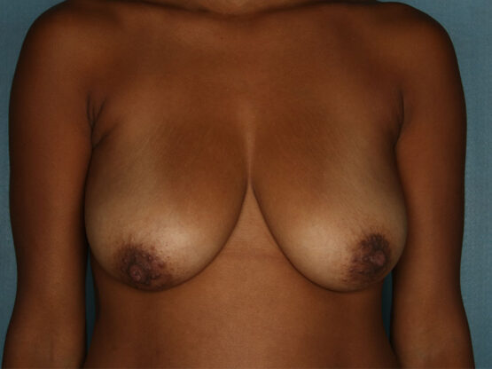 Case # 19 before photo