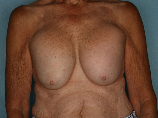 Case # 20 before photo