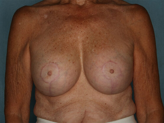 Case # 20 after photo