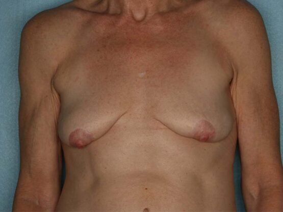 Case # 24 before photo