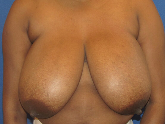 Case # 8 before photo