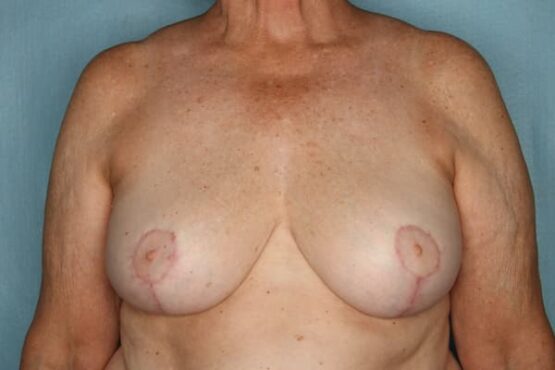 Case # 15 after photo