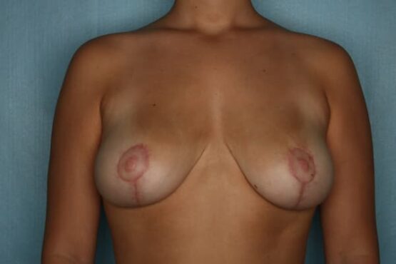 Case # 16 after photo