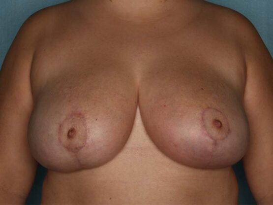 Case # 21 after photo