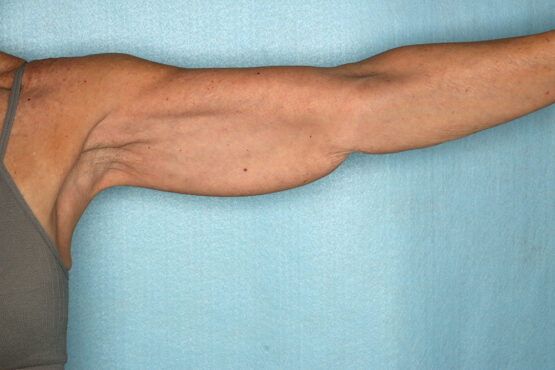 Case # 1 before photo