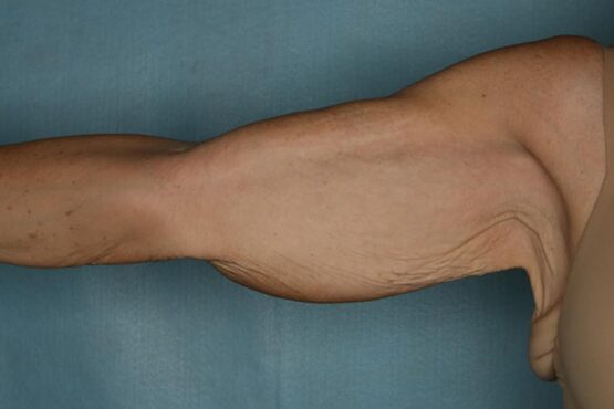 Case # 2 before photo