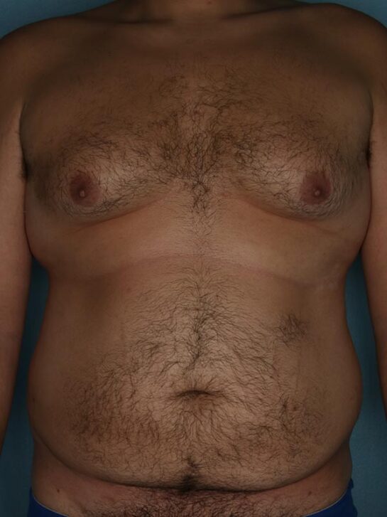 Case # 3 before photo