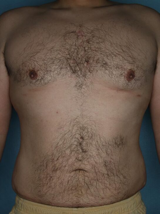 Case # 3 after photo