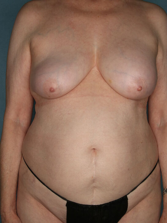 Case # 3 before photo