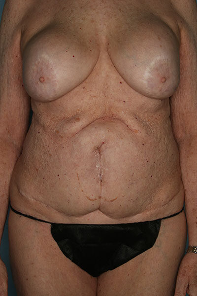 Case # 6 before photo