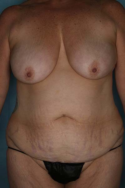 Case # 13 before photo