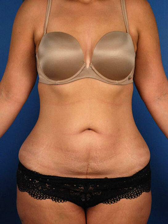 Case # 7 before photo