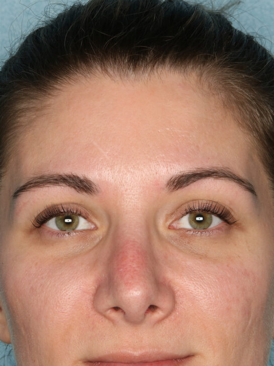 Case # 2 after photo