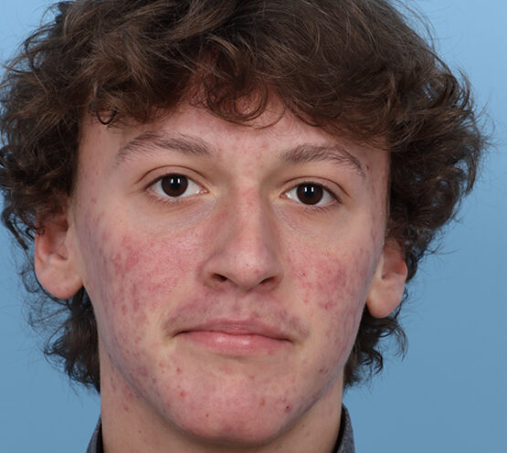 Case # 1 before photo