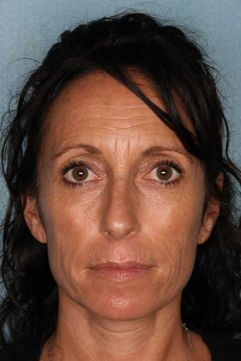 Case # 3 before photo