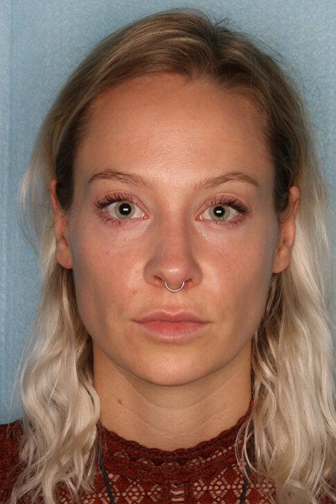 Case # 4 before photo