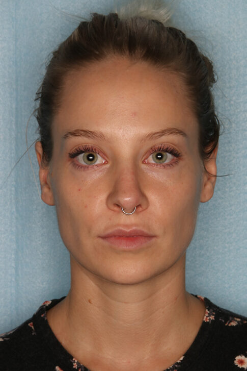 Case # 4 after photo