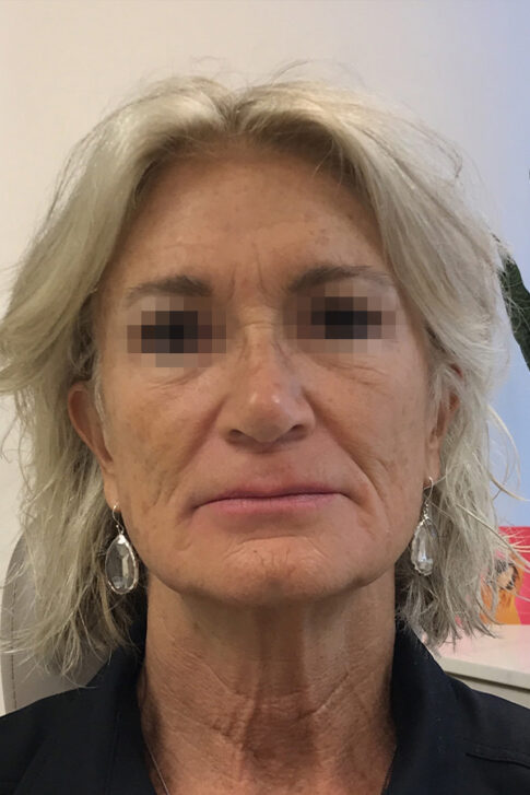 Case # 5 before photo