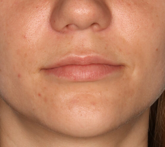 Case # 6 before photo