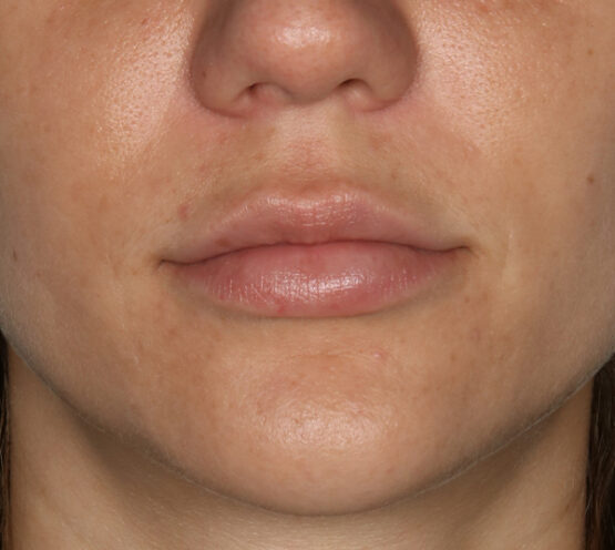 Case # 6 after photo