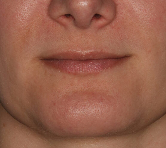 Case # 7 before photo