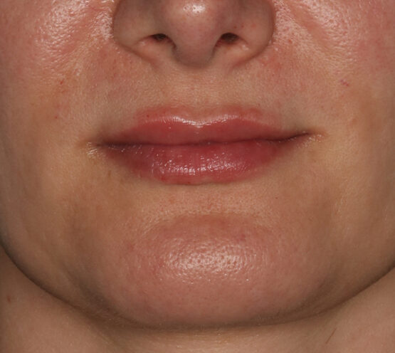 Case # 7 after photo