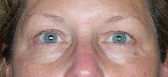 Case # 9 before photo