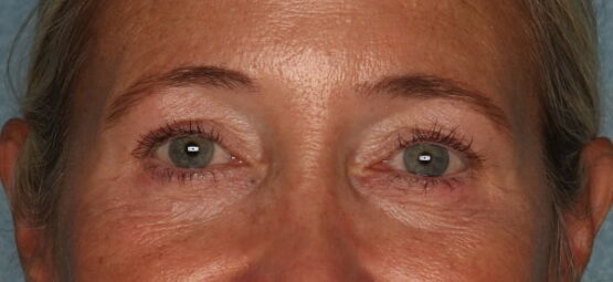 Case # 10 after photo