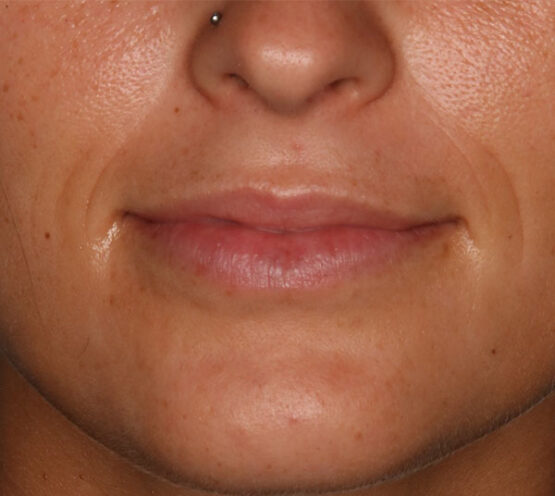 Case # 11 before photo