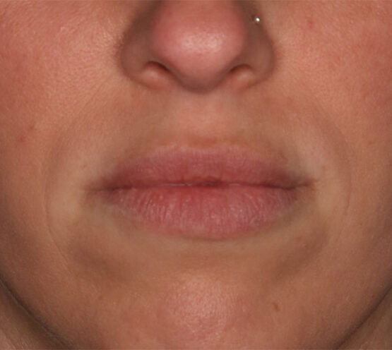 Case # 12 before photo