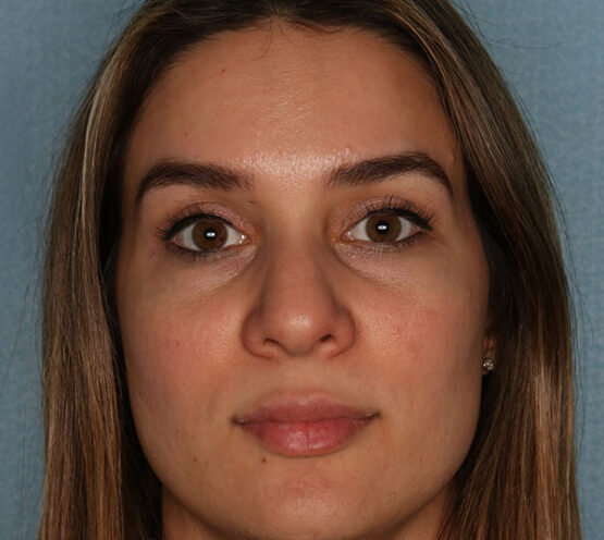 Case # 13 before photo