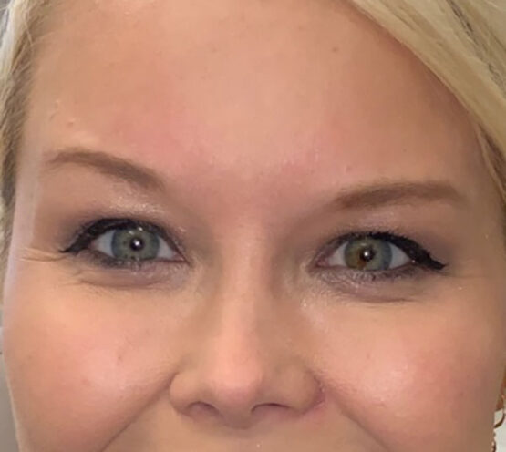 Case # 14 after photo