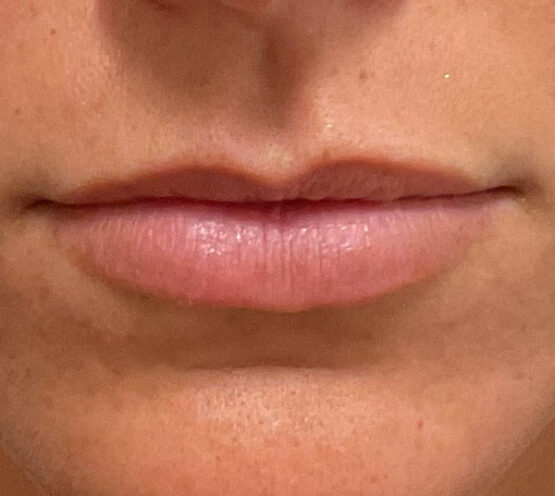 Case # 16 before photo